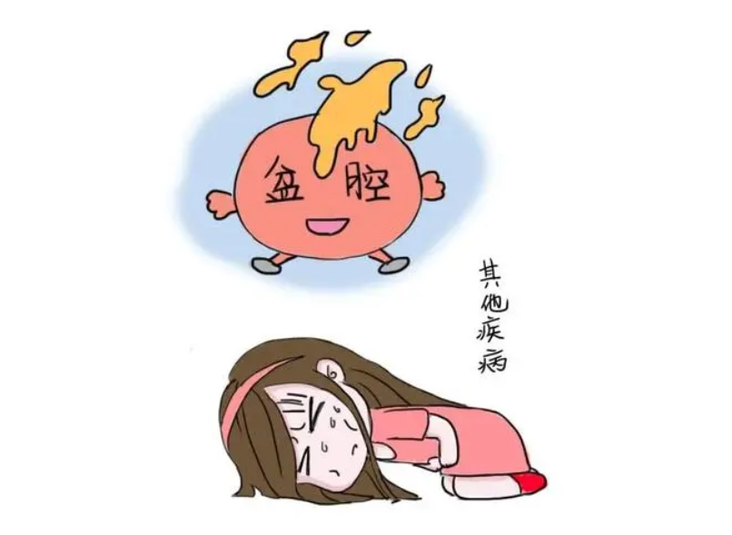 盆腔炎的主要病因是什麽.jpg 盆腔炎的主要病因是什麽.jpg