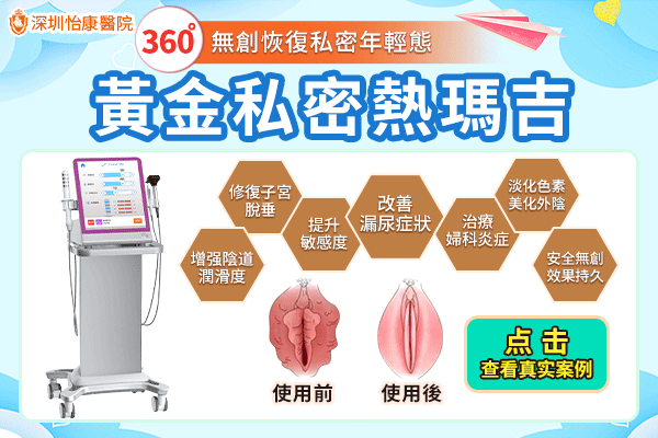 陰唇太黑可以做粉嫩手術嗎?邊啲人適合做熱瑪吉私密粉嫩療程