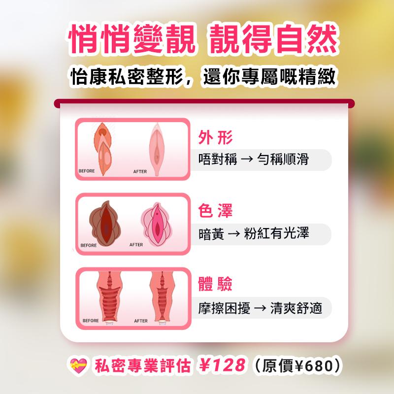 深圳怡康醫院陰唇整形價格多少？按需求選，唔使盲搶貴價項目