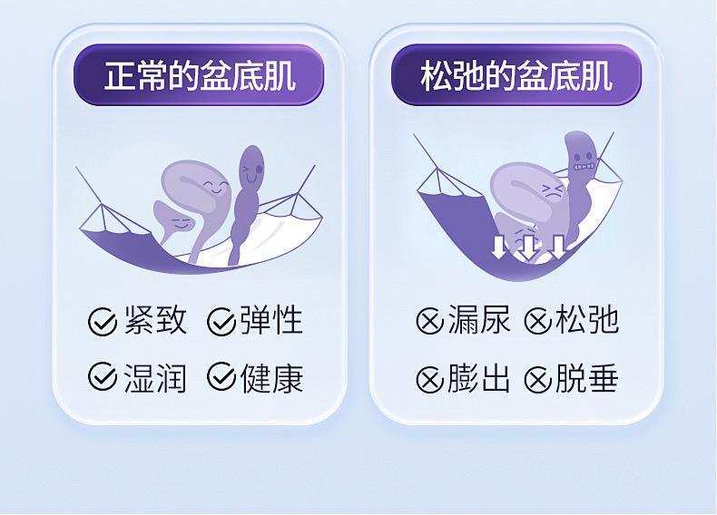子宮脫垂、產後漏尿、盆底鬆弛，要唔要緊？