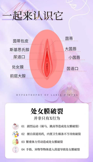 32bd9951-ef34-4d79-865f-8acf7d197b65.png